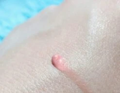 Biodermal Sun Lipbalm SPF25 - Tube 12 Ml - Natural Pink - Lippenbalsem -Hoogwaardige Cosmetica 1200x927 1